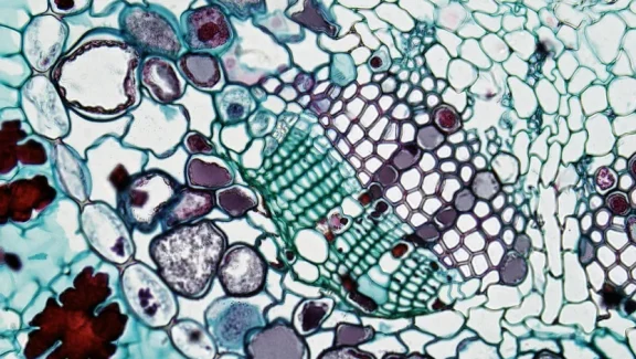 Photo by Fayette Reynolds M.S. pexels 11198526